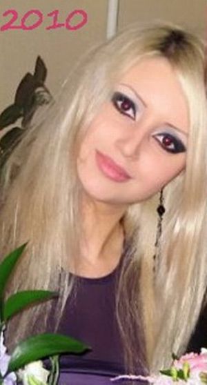 Девушка до и после операции