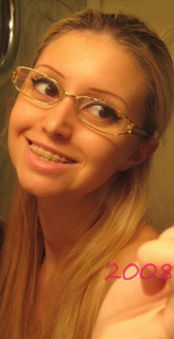 Девушка до и после операции