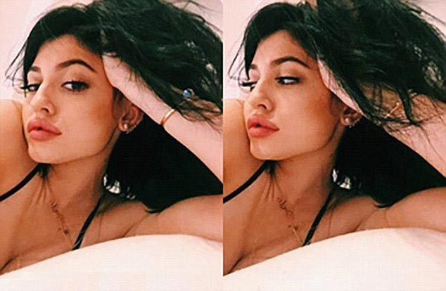 Девушка купила в интернете увеличитель губ...