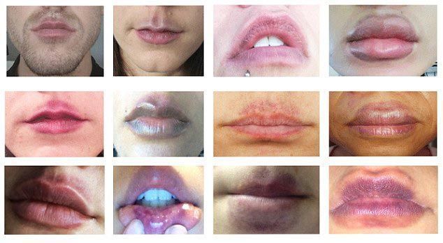 Девушка купила в интернете увеличитель губ...