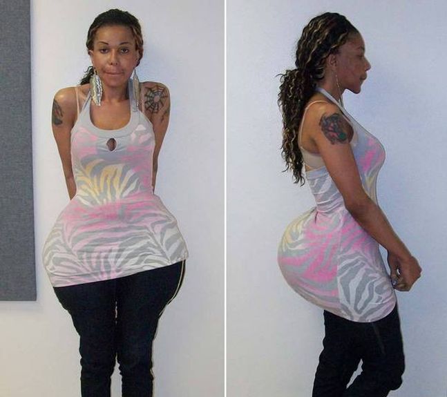 Девушки с силиконовыми попами