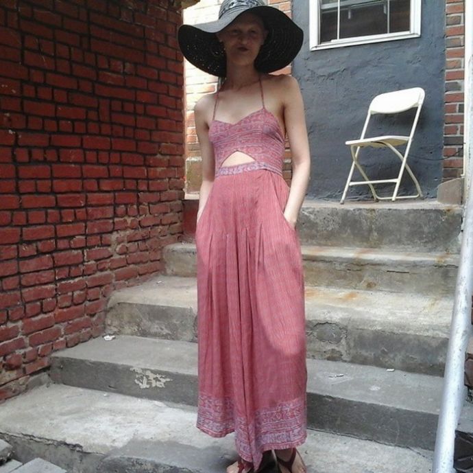 Модель с редким генетическим расстройством не хочет меняться