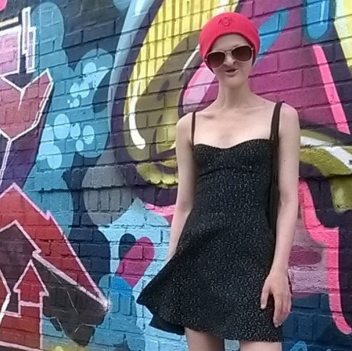 Модель с редким генетическим расстройством не хочет меняться