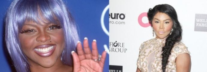 Неудачные пластические операции звезд