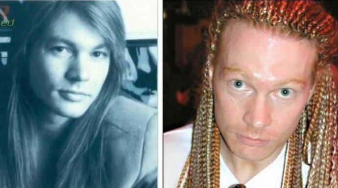 Неудачные пластические операции звезд