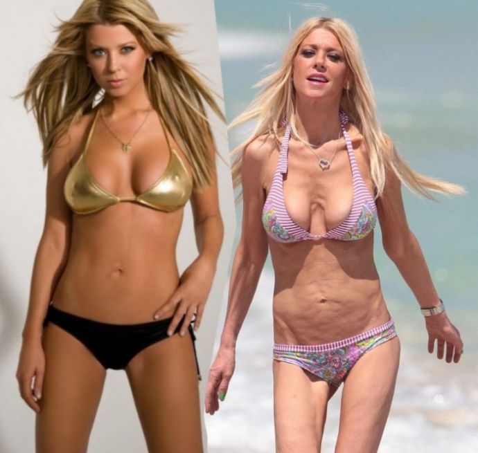 Неудачные пластические операции звезд