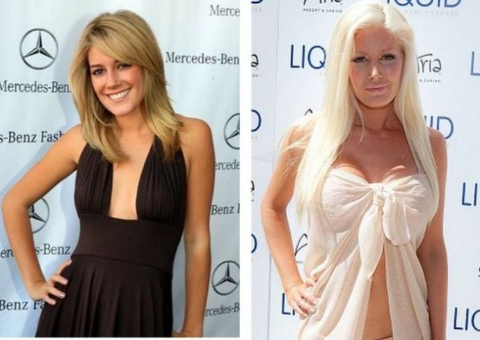 Неудачные пластические операции звезд