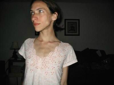 Фото девушек - Анорексички