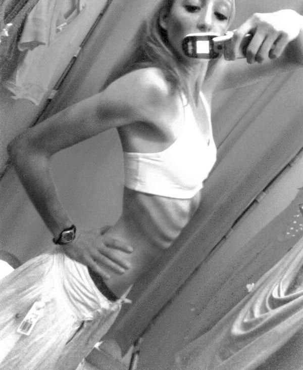 Фото девушек - Анорексички