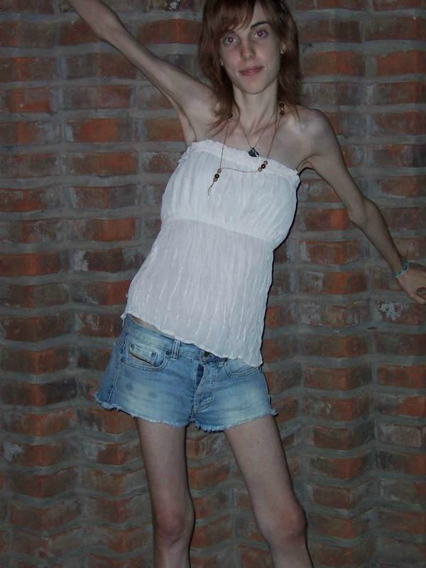 Фото девушек - Анорексички