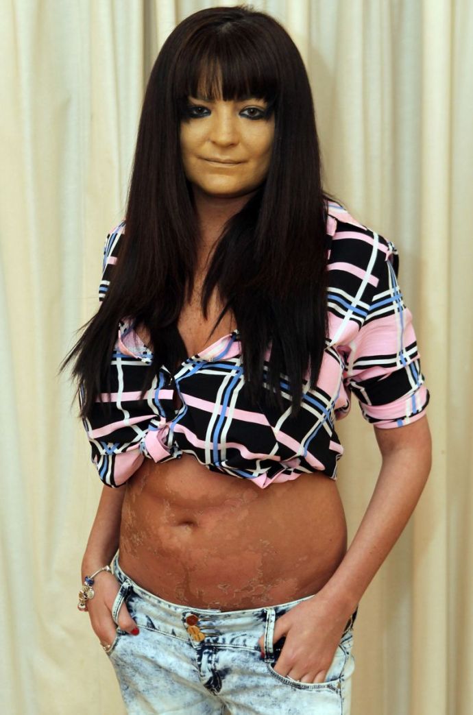 Актриса взрослого кино переусердствовала с солярием