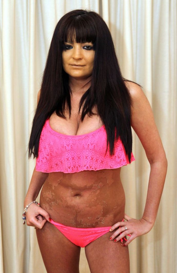 Актриса взрослого кино переусердствовала с солярием