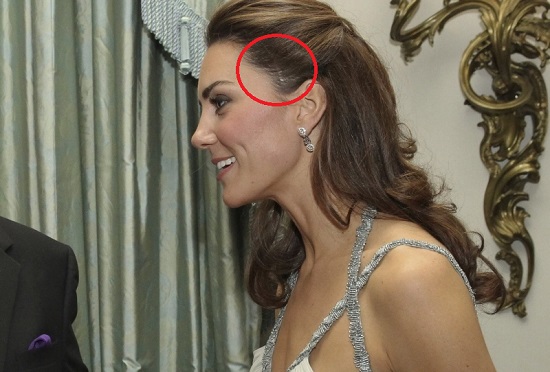 Шрамы и голливудские звезды Шрамы и голливудские звезды