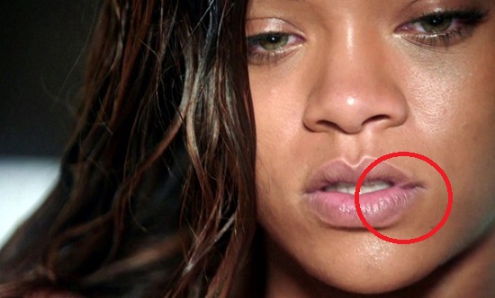 Шрамы и голливудские звезды Шрамы и голливудские звезды