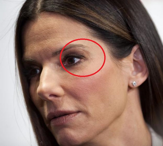 Шрамы и голливудские звезды Шрамы и голливудские звезды