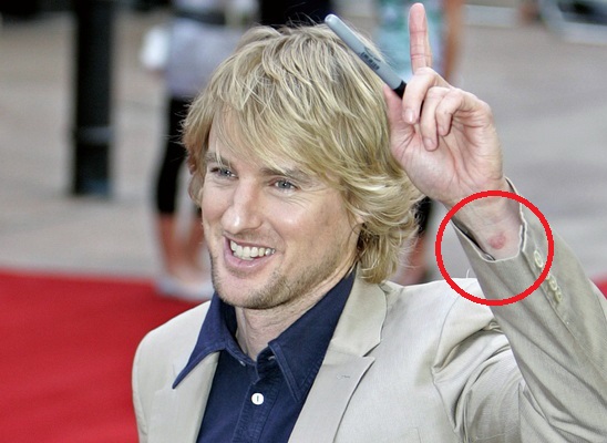 Шрамы и голливудские звезды Шрамы и голливудские звезды