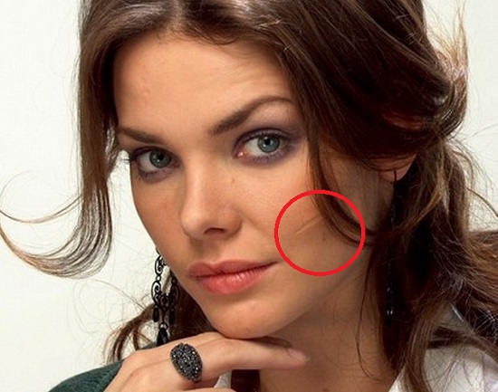 Шрамы и голливудские звезды Шрамы и голливудские звезды