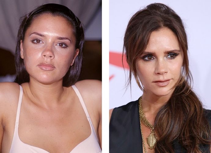 Знаменитости, решившие уменьшить свой нос