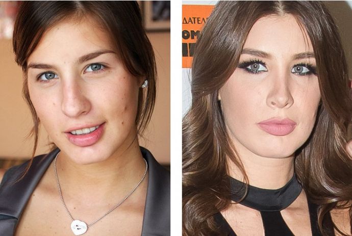 Знаменитости, решившие уменьшить свой нос