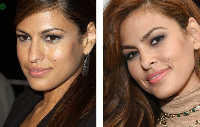 Знаменитости, решившие уменьшить свой нос