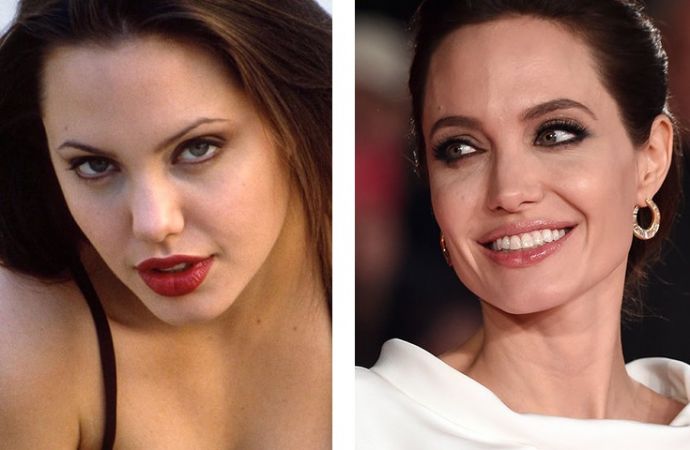 Знаменитости, решившие уменьшить свой нос