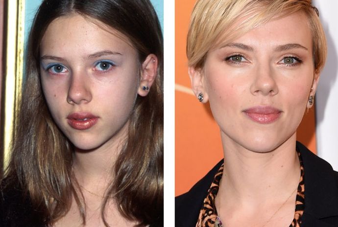 Знаменитости, решившие уменьшить свой нос