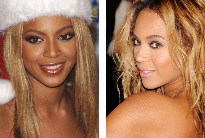 Знаменитости, решившие уменьшить свой нос