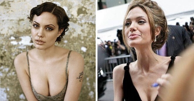 10 звезд, которые испоганили свою внешность худобой 10 звезд, которые испоганили свою внешность худобой