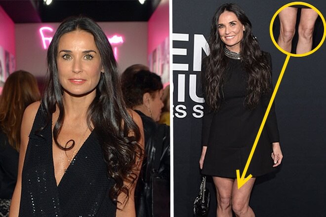 10 звезд, которые испоганили свою внешность худобой 10 звезд, которые испоганили свою внешность худобой