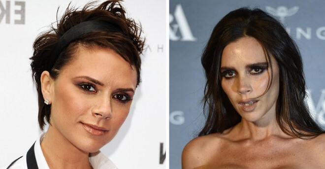 10 звезд, которые испоганили свою внешность худобой