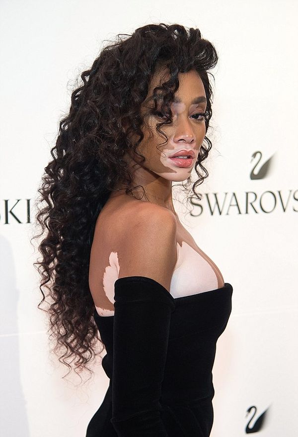 Модель дня Winnie Harlow