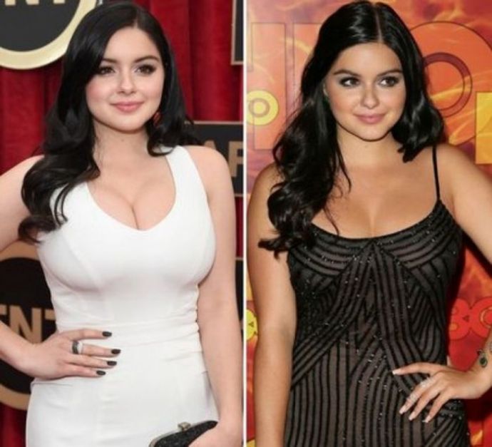 Знаменитости, которые уменьшили грудь