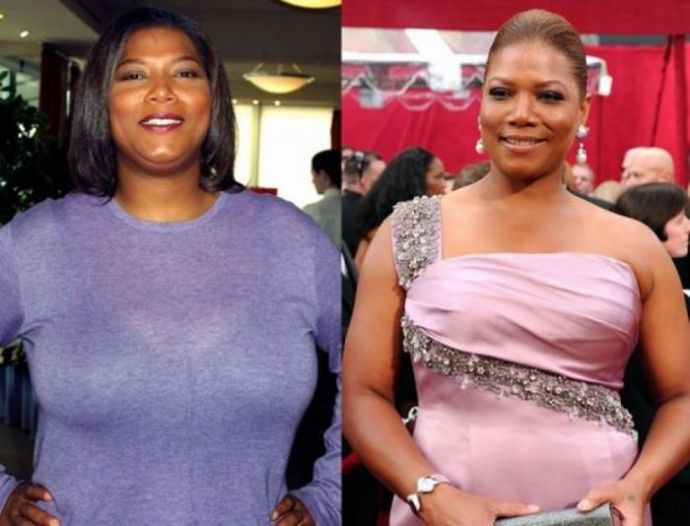 Знаменитости, которые уменьшили грудь