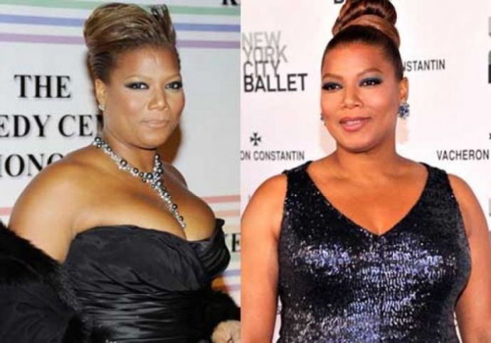 Знаменитости, которые уменьшили грудь