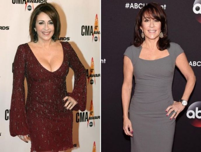 Знаменитости, которые уменьшили грудь