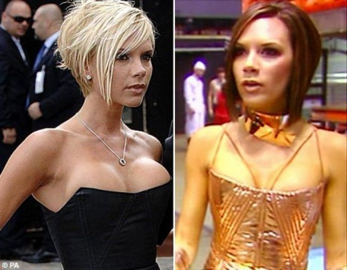 Знаменитости, которые уменьшили грудь