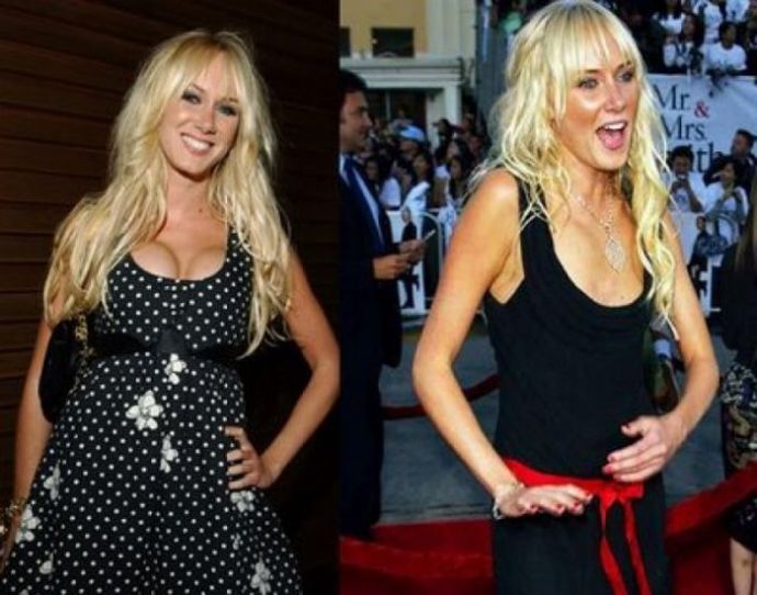 Знаменитости, которые уменьшили грудь