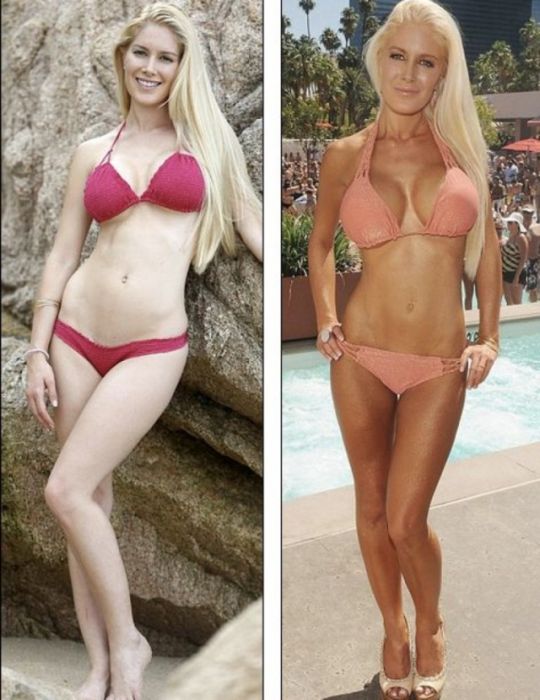 Знаменитости, которые уменьшили грудь Знаменитости, которые уменьшили грудь