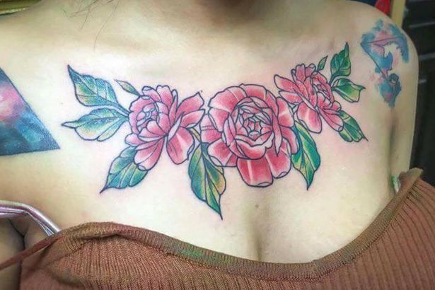 Последствия выведения тату с сисек студентки Последствия выведения тату с сисек студентки