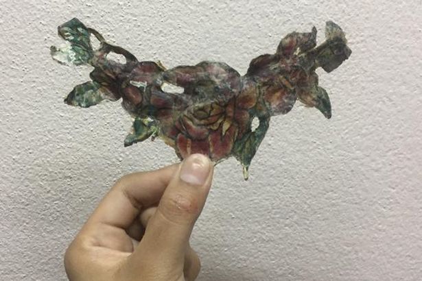 Последствия выведения тату с сисек студентки Последствия выведения тату с сисек студентки