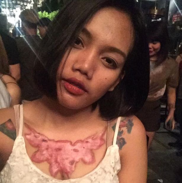 Последствия выведения тату с сисек студентки Последствия выведения тату с сисек студентки