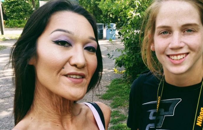 Молодая девушка с кожей старухи строит карьеру модели