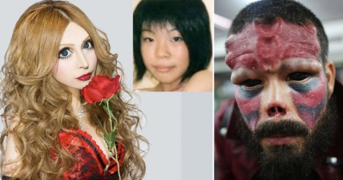 Жертвы пластической хирургии, которые зашли слишком далеко