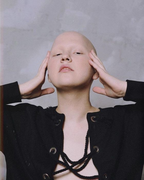 Сложно поверить, что эти девушки востребованные модели Сложно поверить, что эти девушки востребованные модели