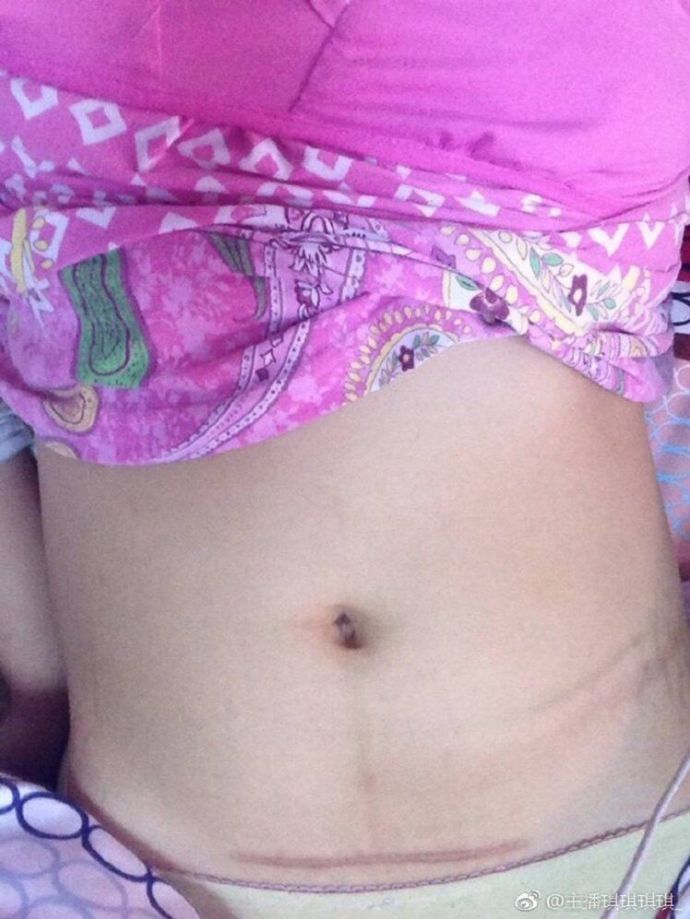 Вот, что бывает когда мастурбируешь морским угрём