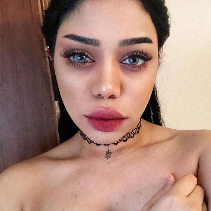 Что не так у девушки с глазом?