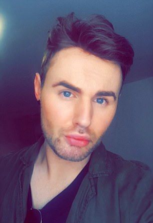 Новая шевелюра для лысого гея Новая шевелюра для лысого гея