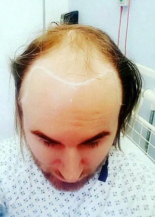 Новая шевелюра для лысого гея Новая шевелюра для лысого гея