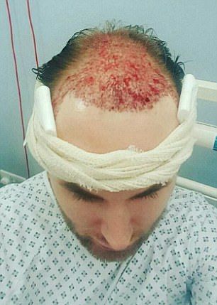 Новая шевелюра для лысого гея Новая шевелюра для лысого гея