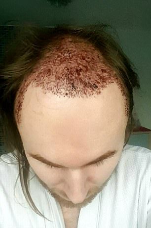 Новая шевелюра для лысого гея Новая шевелюра для лысого гея